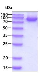 SDS-PAGE (CD4-39H).jpg